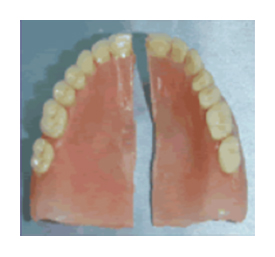 Common Broken Dentures due to Fragility