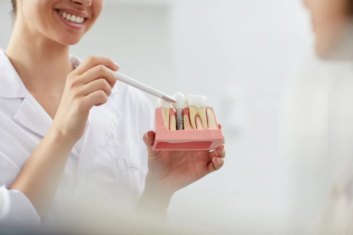 Dentist showing dental implant model