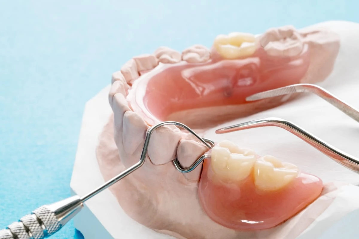 Partial denture model